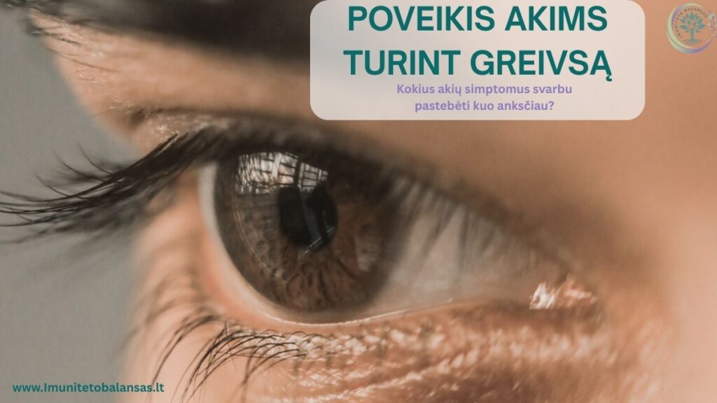 Kodėl Greivso liga gali paveikti akis?
