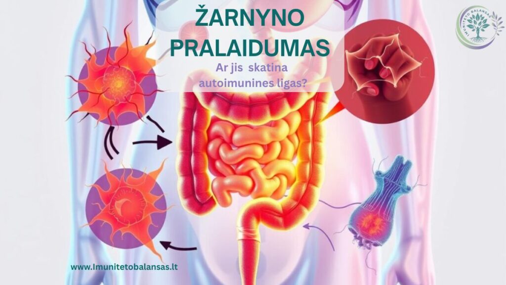 Žarnyno pralaidumas ir autoimuninės ligos infografika