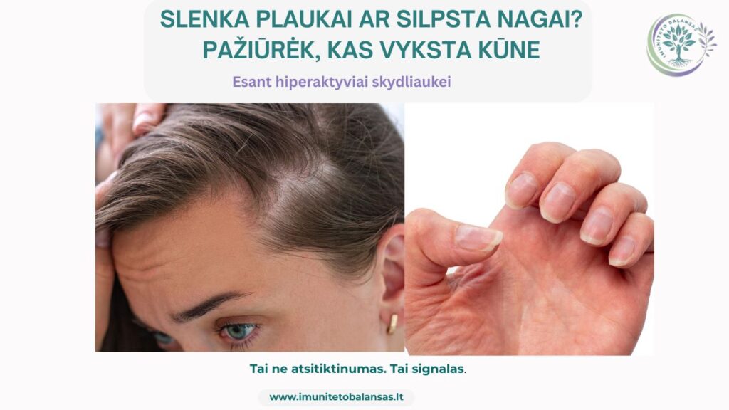 Plaukų slinkimas ir nagų lūžinėjimas esant hiperaktyviai skydliaukei
